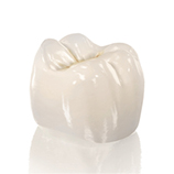 Sanfte Implantolgie eines Zahnes