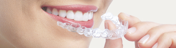 Invisalign - Dr. Matheis